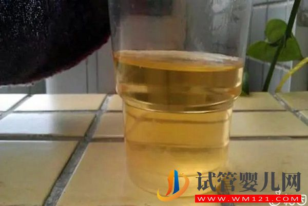 質疑安弘胎兒性別測試杯，從原理分析探討可信度(圖2)