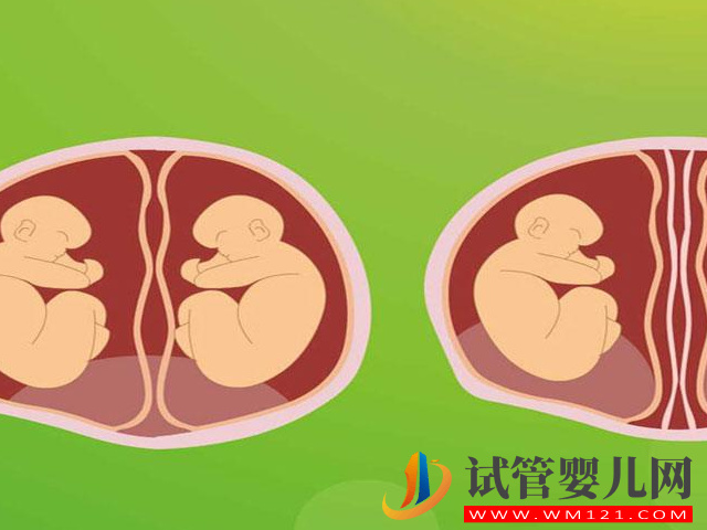 試管嬰兒中的“單卵雙胎”可不是好事,早產(chǎn)、畸形風險高(圖5) 試管嬰兒中的“單卵雙胎”可不是好事,早產(chǎn)、畸形風險高(圖5)