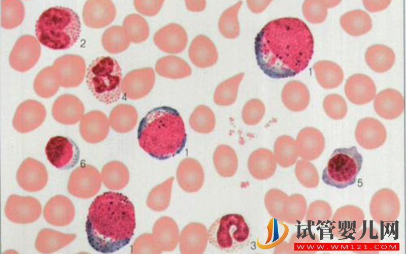 在美國les用骨髓技術生孩子要多少錢？(圖1)