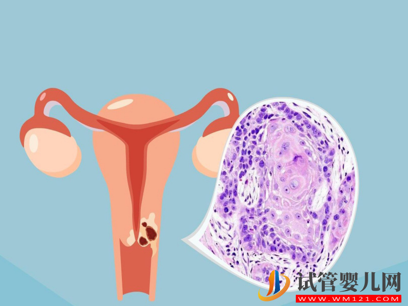 卵泡萎縮會影響試管成功率，19個卵泡懷孕幾率也很低(圖1)