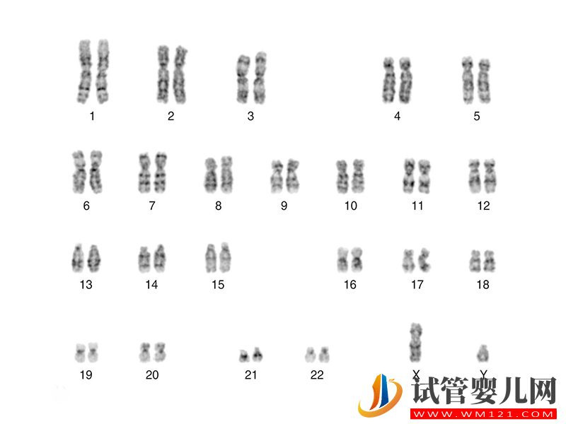 克氏綜合征易導致第三性別，竟都是染色體XXY闖的禍(圖1)