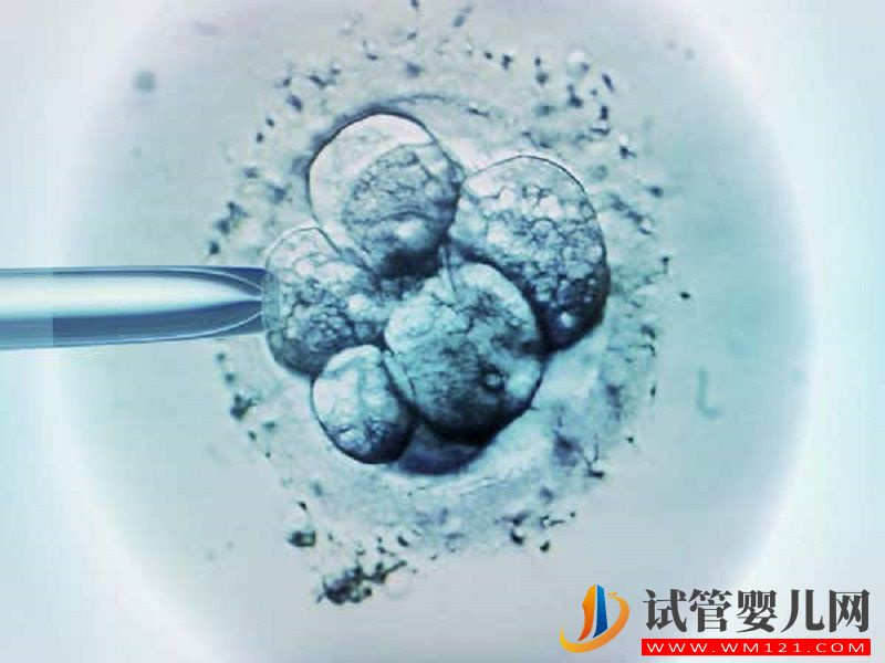 詳解一代二代試管的區別，適應人群、費用各有不同(圖1)