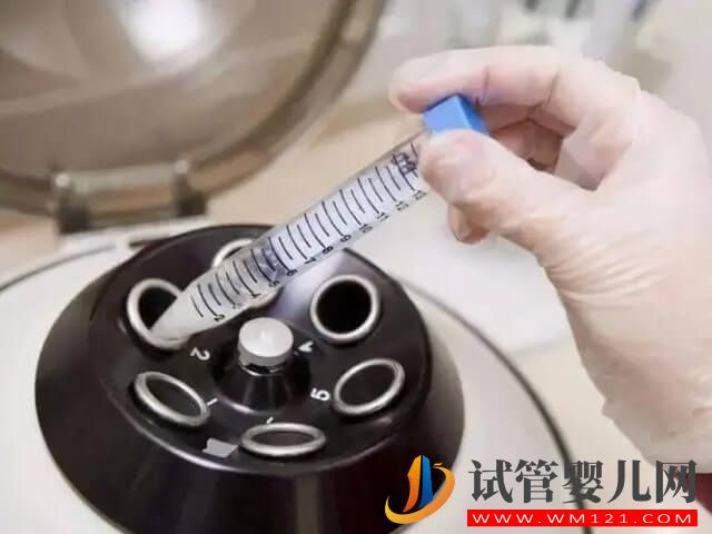 試管嬰兒輔助生殖技術中的ivm是什么意思？(圖1)