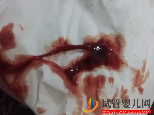 長期月經量都特別少能做試管嬰兒懷孕嗎？(圖1)