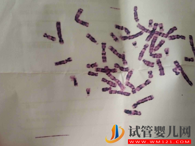 三代試管才是反復胎停的優質選擇，看完其中緣由就明白了(圖1)