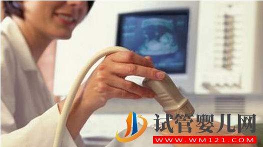試管嬰兒促排卵超聲檢查為什么要選擇在月經期進行呢？(圖2)