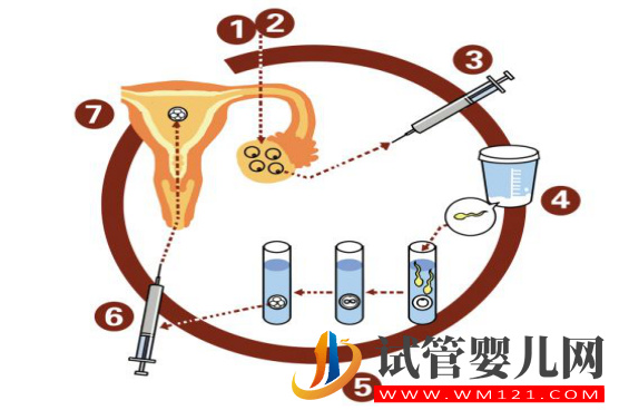 試管嬰兒移植前的準備工作(圖1)