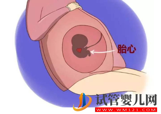 試管嬰兒胚胎移植后腹部兩側疼是不是宮外孕？(圖2)