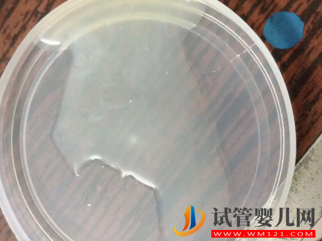 精子檢查報告單正確打開方式，看這7項主要數值就能知全貌(圖4)