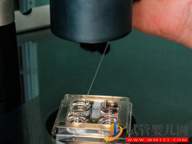 三代試管嬰兒全過程詳解，一切順利的話僅需2個月(圖3)