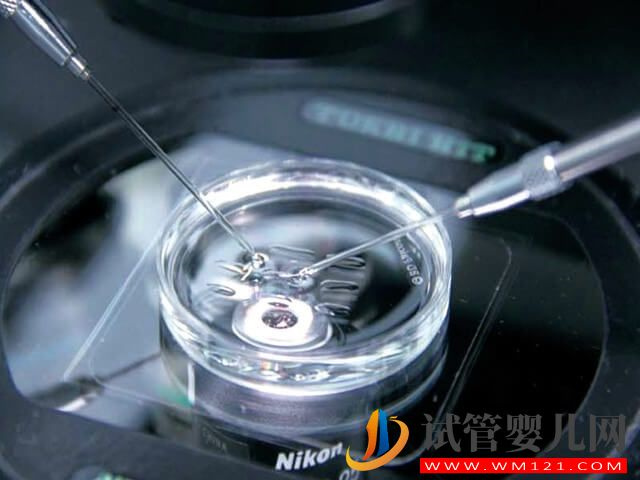 姐妹們拉拉人群供精做試管嬰兒只能生女孩嗎？(圖1)