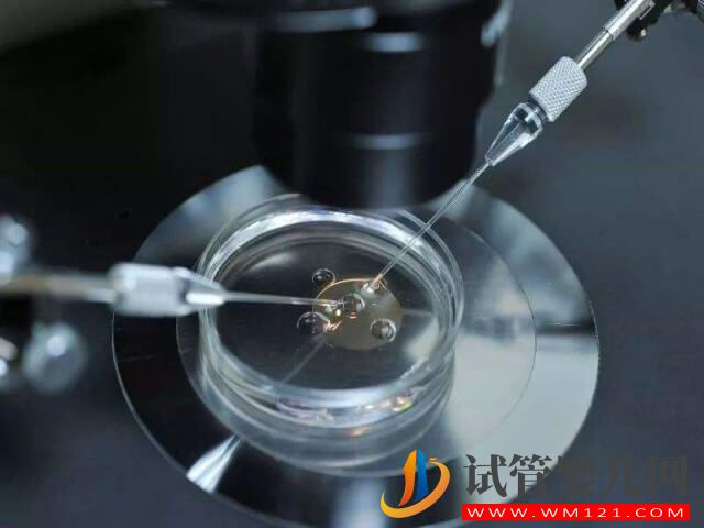 進行洗精術之前需要先確定精子的活力嗎？(圖1)