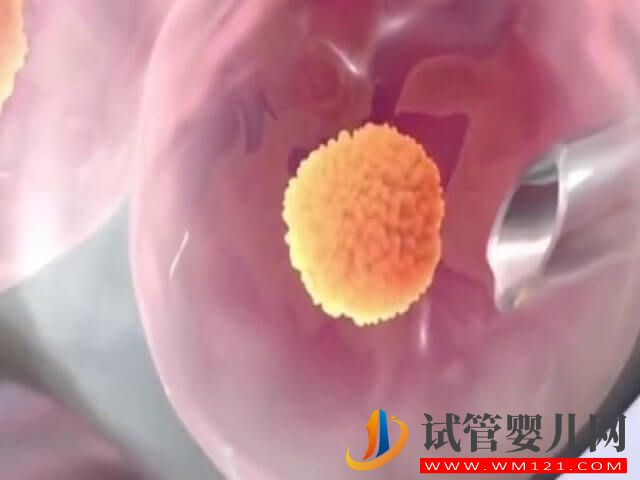 在石家莊做一次試管嬰兒大概需要多少錢？(圖2)