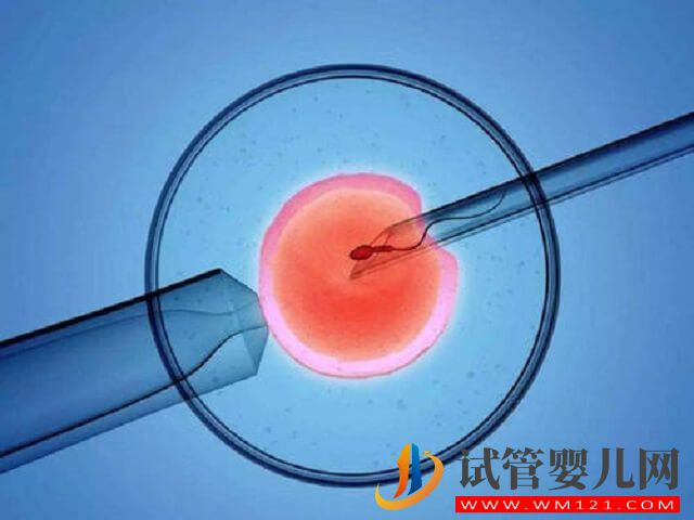 威海婦幼醫(yī)院的二代試管成功率有多少？(圖2)