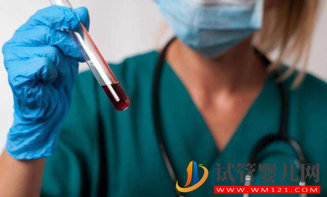 試管嬰兒前期檢查項(xiàng)目報(bào)告你看的懂嗎?看完就會(huì)了(圖2) 試管嬰兒前期檢查項(xiàng)目報(bào)告你看的懂嗎?看完就會(huì)了(圖2)