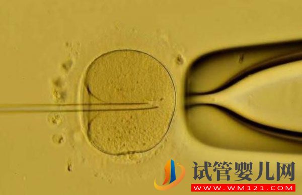 試管嬰兒鮮胚移植成功率高嗎？哪些情況不能移植鮮胚(圖1)