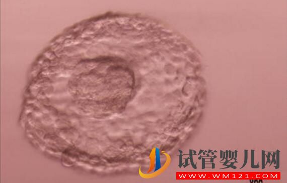 試管嬰兒養囊胚是什么樣的？什么樣的囊胚質量好？(圖2)