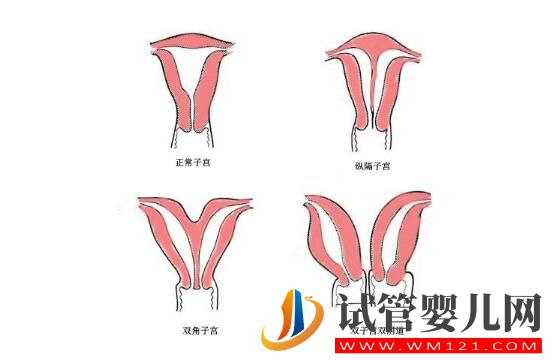子宮偏小的女性做試管嬰兒嗎？來看看吧(圖1)