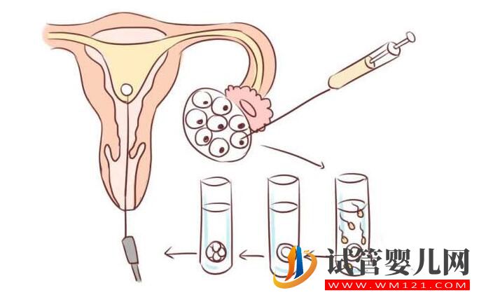 試管嬰兒移植雙胞胎好嗎?去泰國(guó)做成功率怎么樣(圖3) 試管嬰兒移植雙胞胎好嗎?去泰國(guó)做成功率怎么樣(圖3)