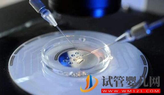 試管嬰兒促排不會(huì)選擇方案 一文加深你對(duì)促排卵方案的了(圖5) 試管嬰兒促排不會(huì)選擇方案 一文加深你對(duì)促排卵方案的了(圖5)