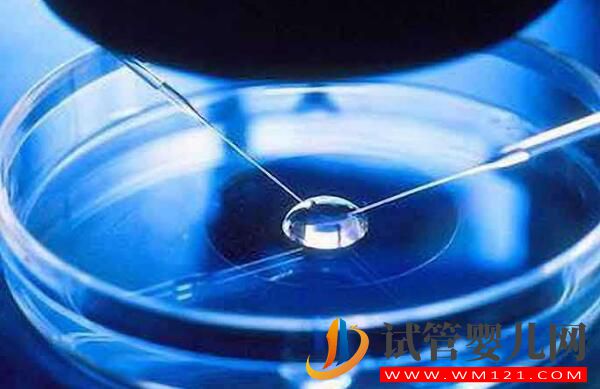 試管嬰兒要在體外培育多長時間？時間越長越好嗎？(圖1)