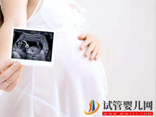 四維b超單子上有男女的暗示，有這兩點基本是男孩了(圖1)