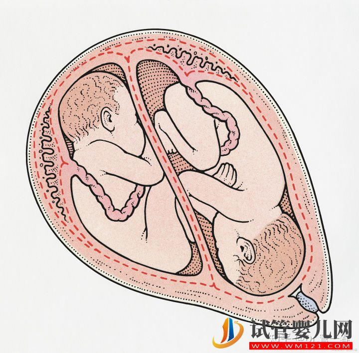 卵巢早衰的5個原因,要注意!趕緊及時排查(圖1)