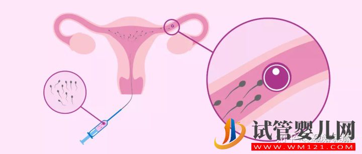 一篇文章看懂輔助生殖(圖3)