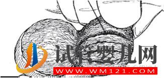 上海市一新增1例無精治療成功案例(圖1)