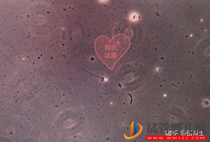 上海市一新增1例無精治療成功案例(圖3)