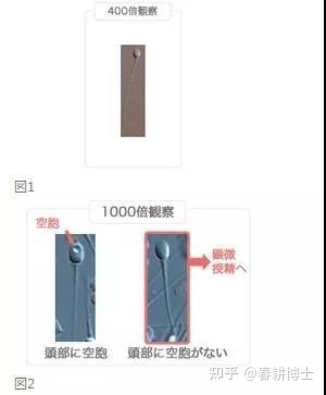 要不要養囊胚,如何提高養囊成功率(圖7)