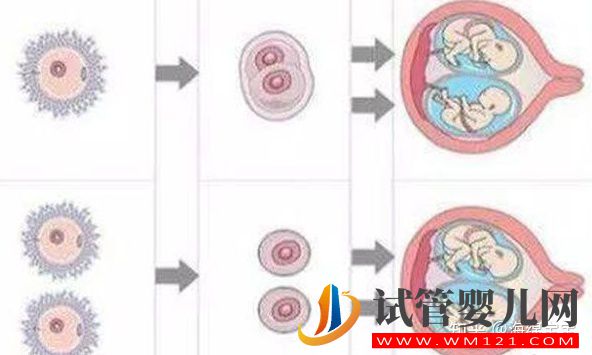 龍鳳胎是怎么形成的_龍鳳胎形成過程(圖2)
