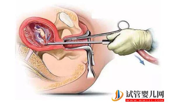 成都如何擁有好的內膜？(圖1)
