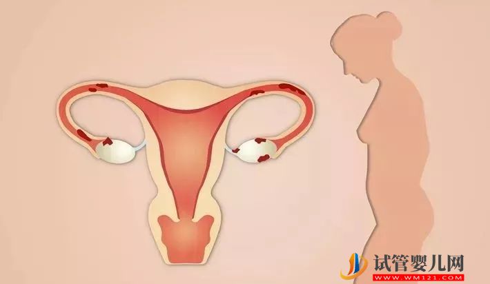 武漢女人習慣性流產會有哪些癥狀表現?(圖1)