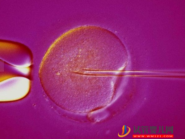 促排空卵泡能否長大到成熟并自然排除(圖2)