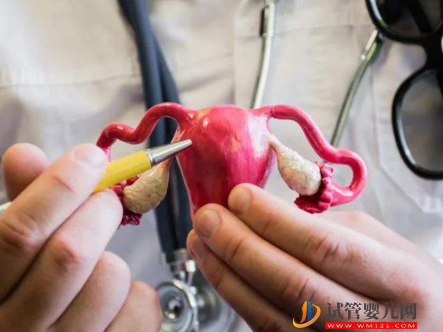 圖解多囊卵巢的不同類型，是輕是重看完見分曉(圖3)