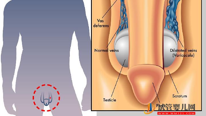 男性性功能障礙12個致病因素 五種水果能預(yù)防性功能障礙(圖3)
