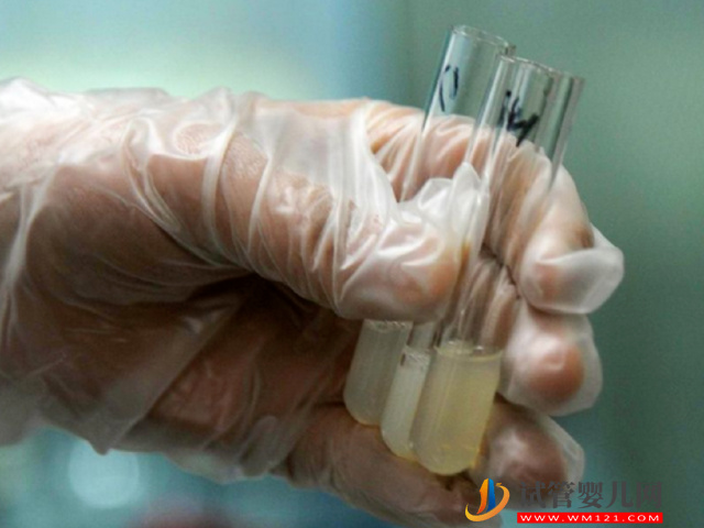 無精癥恢復生精功能并不困難，吃藥、手術都能有效解決(圖2)