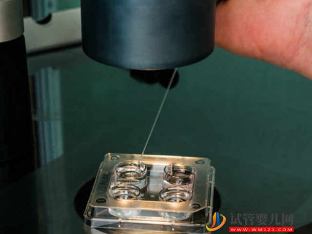 無精癥恢復生精功能并不困難，吃藥、手術都能有效解決(圖4)