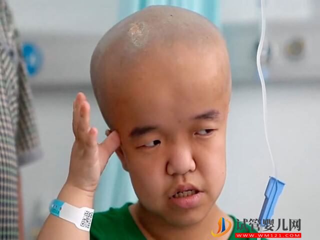 人體第19號常染色體出現三體的后果都有哪些？(圖1)