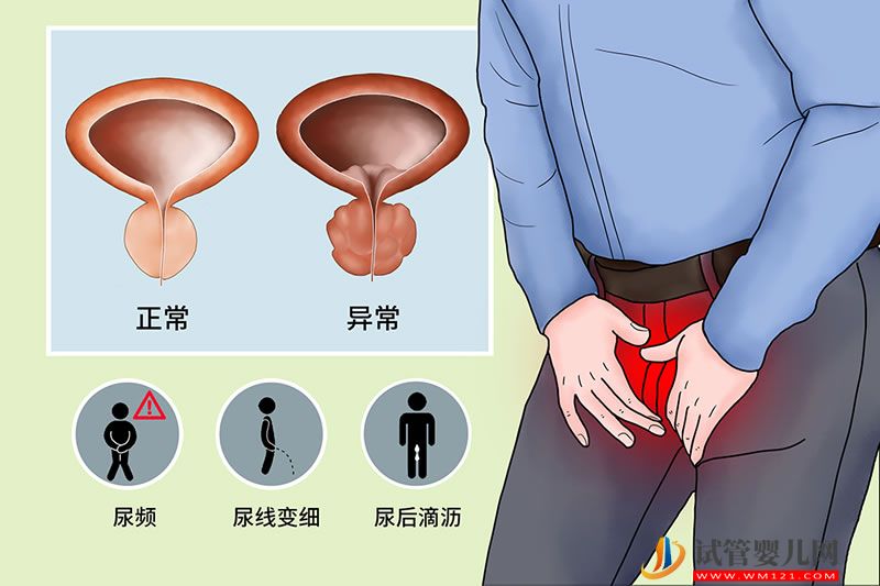 首創(chuàng)口服化療藥物能治療前列腺癌(圖1)