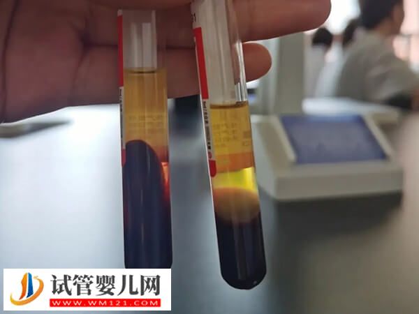 凍胚移植hcg翻倍對照表，雙胎翻倍時間居然比單胎長那么多(圖3)