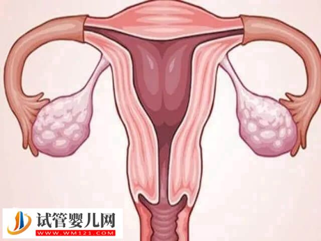 子宮疤痕憩室可不可以做試管嬰兒(圖1)