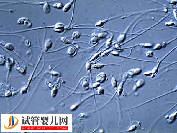 男性的精子活力達到多少才可以做二代試管嬰兒(圖2)