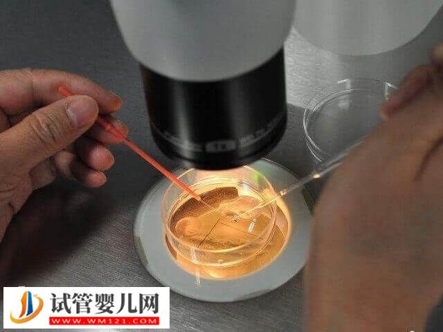 胚胎培養液對試管嬰兒有沒有影響(圖1)