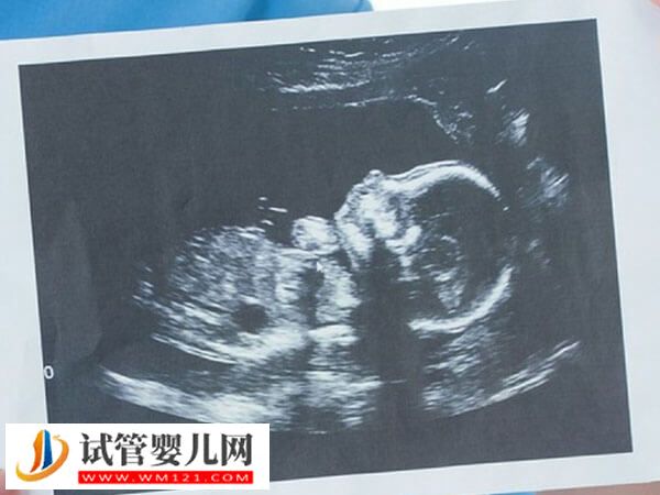 上海集愛(ài)醫(yī)院助孕步驟分享，掛號(hào)到驗(yàn)孕流程匯總(圖1)