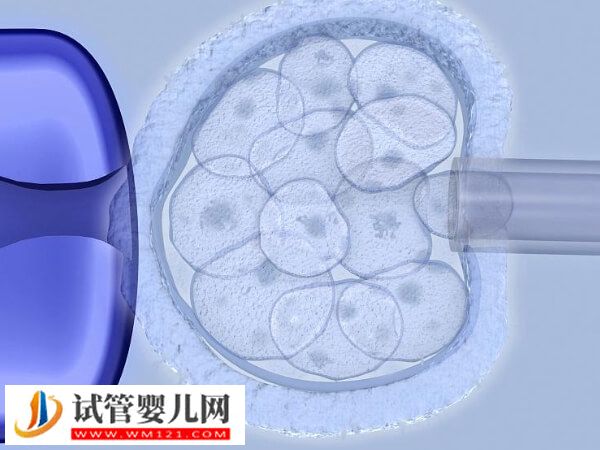 烏魯木齊試管嬰兒醫(yī)生哪個(gè)好(圖1)