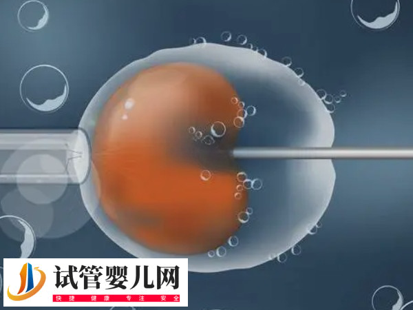 在俄羅斯做試管步驟是什么(圖3) 在俄羅斯做試管步驟是什么(圖3)