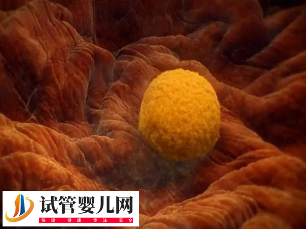 前往俄羅斯做試管移植技術好不好(圖1)