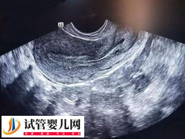 深圳三代試管的醫(yī)院有哪些(圖3)